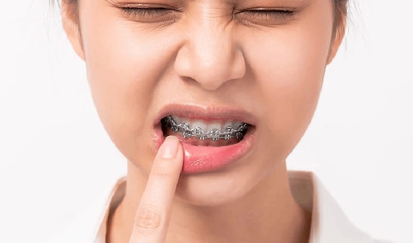 Orthodontic Emergency