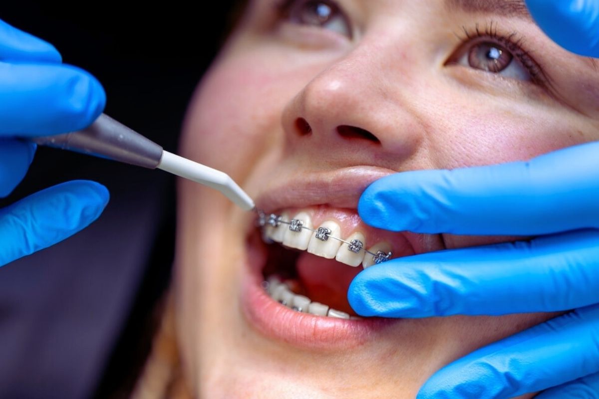 what is an orthodontic emergency