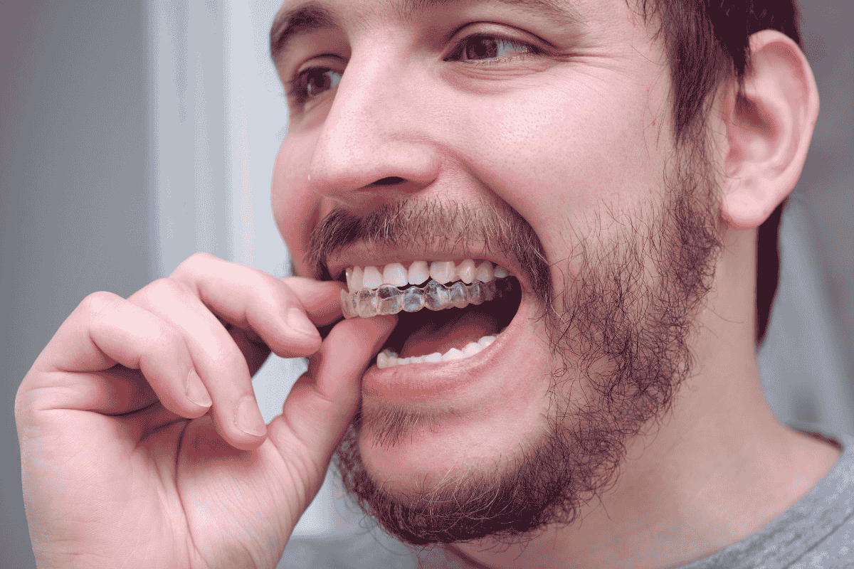 Man fitting invisalign aligners on teeth