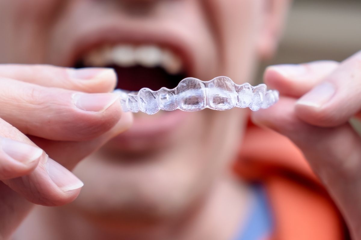 Will Missing Invisalign Wear Delay Your Smile